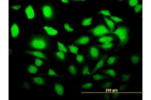 Immunofluorescence of monoclonal antibody to SLC2A4RG on HeLa cell. (SLC2A4RG 抗体  (AA 178-269))