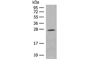 Western blot analysis of Human placenta tissue lysate using MDFI Polyclonal Antibody at dilution of 1:400 (MDFI 抗体)
