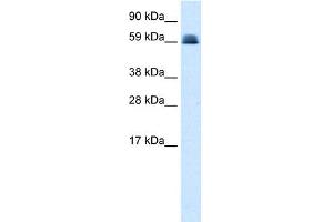 WB Suggested Anti-ZNF499 Antibody Titration: 0. (ZBTB45 抗体  (Middle Region))