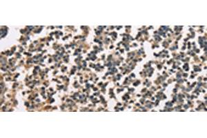 Immunohistochemistry of paraffin-embedded Human tonsil tissue using ZFYVE19 Polyclonal Antibody at dilution of 1:60(x200) (ZFYVE19 抗体)