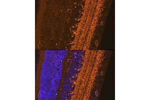 Immunofluorescence analysis of Rat eyeball using G/G/G antibody (ABIN3017018, ABIN3017019, ABIN3017020 and ABIN6219924) at dilution of 1:100. (GAD 抗体  (AA 1-200))