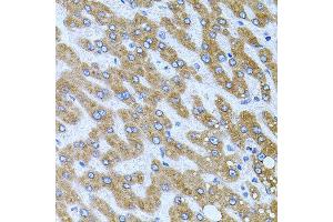 Immunohistochemistry of paraffin-embedded human liver injury using CPM antibody at dilution of 1:100 (x40 lens). (CPM 抗体)