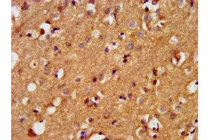 IHC image of ABIN7145227 diluted at 1:400 and staining in paraffin-embedded human brain tissue performed on a Leica BondTM system. (BAIAP3 抗体  (AA 131-257))