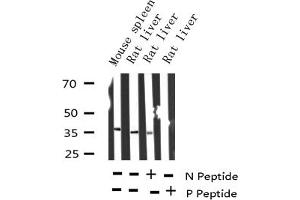 Western blot analysis of Phospho-I kappaB epsilon (Ser22) expression in various lysates (NFKBIE 抗体  (pSer161))