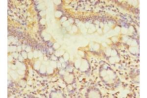 Immunohistochemistry of paraffin-embedded human small intestine tissue using ABIN7171449 at dilution of 1:100 (TCP11L2 抗体  (AA 1-210))