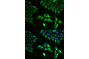 Immunofluorescence analysis of U2OS cells using ACADS antibody. (ACADS 抗体)