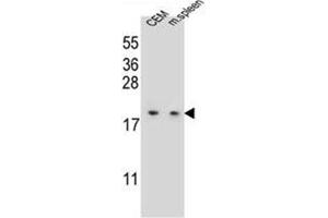 Western Blotting (WB) image for anti-LSM7 Homolog, U6 Small Nuclear RNA Associated (LSM7) (AA 52-80), (C-Term) antibody (ABIN953244)