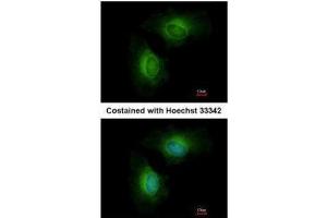 Immunofluorescence (IF) image for anti-Cytochrome P450, Family 1, Subfamily B, Polypeptide 1 (CYP1B1) (Center) antibody (ABIN2855824)