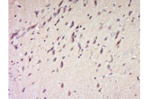 Immunohistochemistry (Paraffin-embedded Sections) (IHC (p)) image for anti-B-Cell CLL/lymphoma 2 (BCL2) (AA 51-150) antibody (ABIN1713650)