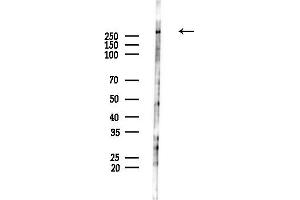 Western blot analysis of lysates from HUVEC cells(LPS,4h treatment), using Phospho-Filamin A (Ser2152) Antibody at 1/1000 dilution.