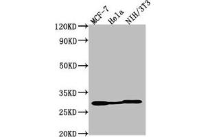 Western Blot Positive WB detected in: MCF-7 whole cell lysate, Hela whole cell lysate, NIH/3T3 whole cell lysate All lanes: LGALS3 antibody at 1:2000 Secondary Goat polyclonal to Mouse IgG at 1/50000 dilution Predicted band size: 27 kDa Observed band size: 27 kDa (Galectin 3 抗体)