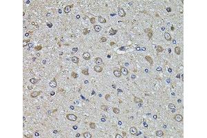 Immunohistochemistry of paraffin-embedded Rat brain using EPHA3 Polyclonal Antibody at dilution of 1:100 (40x lens). (EPH Receptor A3 抗体)