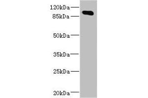 Western blot All lanes: MAP4K5 antibody at 4. (MAP4K5 抗体  (AA 300-480))