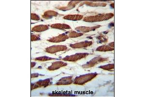 USP45 Antibody (Center) (ABIN657332 and ABIN2846401) immunohistochemistry analysis in formalin fixed and paraffin embedded human skeletal muscle followed by peroxidase conjugation of the secondary antibody and DAB staining. (USP45 抗体  (AA 309-338))