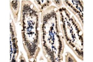 IHC analysis of HP1 alpha/CBX5 using anti-HP1 alpha/CBX5 antibody (ABIN7599058).
