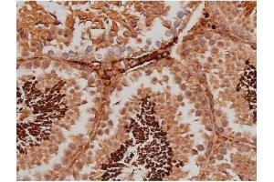 ABIN6267363 at 1/200 staining Mouse testis tissue sections by IHC-P. (MAPT 抗体  (pSer262))