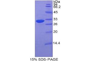 SDS-PAGE analysis of Mouse ETFa Protein. (Electron-Transfer-Flavoprotein, alpha Polypeptide (ETFA) Peptide)