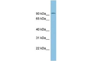 WB Suggested Anti-TLK1 Antibody Titration: 0. (TLK1 抗体  (Middle Region))