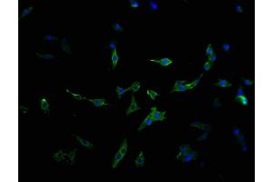 Immunofluorescence staining of MCF-7 cells with ABIN7159373 at 1:100, counter-stained with DAPI. (MBTPS1 抗体  (AA 187-400))