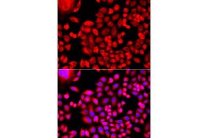 Immunofluorescence analysis of A549 cells using MTHFD1L antibody. (MTHFD1L 抗体  (AA 759-978))