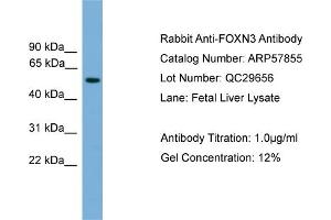 WB Suggested Anti-FOXN3  Antibody Titration: 0. (FOXN3 抗体  (Middle Region))