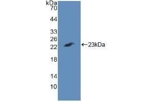 Detection of Recombinant CASP7, Human using Polyclonal Antibody to Caspase 7 (CASP7) (Caspase 7 抗体  (AA 24-198))