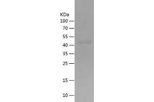 GARS Protein (AA 531-739) (His-IF2DI Tag)