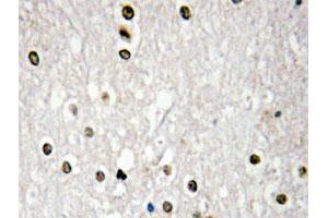 Immunohistochemical analysis of paraffin-embedded human brain tissue using TP73 polyclonal antibody .