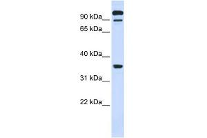 WB Suggested Anti-PTPRE Antibody Titration:  0. (PTPRE 抗体  (Middle Region))