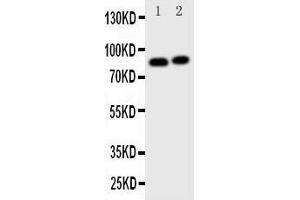 Western Blotting (WB) image for anti-Gelsolin (GSN) (AA 763-775), (C-Term) antibody (ABIN3043978) (Gelsolin 抗体  (C-Term))