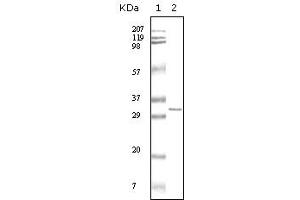 Western blot analysis using HPTR mouse mAb against truncated HPRT recombinant protein. (HPRT1 抗体)