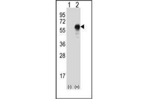 Western blot analysis of LZP (arrow) using LZP Antibody . (OIT3 抗体)