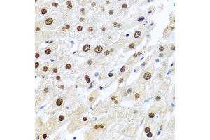 Immunohistochemistry of paraffin-embedded human liver using METTL3 antibody at dilution of 1:100 (40x lens). (METTL3 抗体)