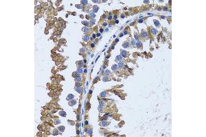 Immunohistochemistry (Paraffin-embedded Sections) (IHC (p)) image for anti-Inositol(myo)-1(or 4)-Monophosphatase 1 (IMPA1) (AA 1-277) antibody (ABIN6142429)