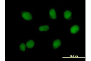 Immunofluorescence of purified MaxPab antibody to RMI1 on HeLa cell. (RMI1 抗体  (AA 1-470))