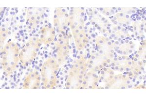 Detection of PCDHb2 in Mouse Kidney Tissue using Polyclonal Antibody to Protocadherin Beta 2 (PCDHb2) (PCDHb2 抗体  (AA 79-253))