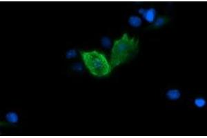 Image no. 3 for anti-Fetal and Adult Testis Expressed 1 (FATE1) antibody (ABIN1498221) (FATE1 抗体)