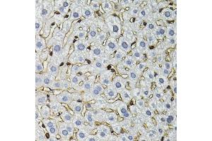 Immunohistochemistry of paraffin-embedded mouse liver using ANXA2 antibody. (Annexin A2 抗体)