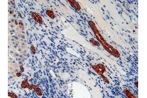 IHC-P analysis of Human Liver Tissue, with DAB staining. (Cytokeratin 7 抗体  (AA 91-394))