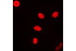 Immunofluorescent analysis of FEN1 staining in MCF7 cells. (FEN1 抗体  (Center))