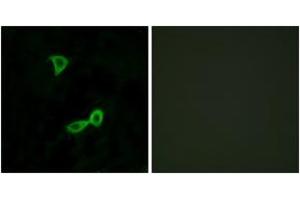 Immunofluorescence analysis of LOVO cells, using GRM2 Antibody. (GRM2 抗体  (AA 241-290))