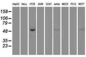 Image no. 2 for anti-serine threonine Kinase 39 (STK39) antibody (ABIN1501212) (STK39 抗体)