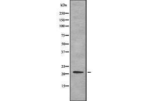 Western blot analysis of ITBP1 expression in HEK293 cells ,The lane on the left is treated with the antigen-specific peptide. (ITGB1BP1 抗体  (Internal Region))