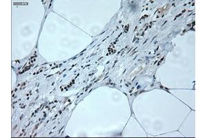 Immunohistochemical staining of paraffin-embedded liver tissue using anti-NEUROG1mouse monoclonal antibody. (Neurogenin 1 抗体)