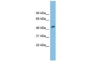 PNPLA1 antibody used at 1 ug/ml to detect target protein. (PNPLA1 抗体  (Middle Region))