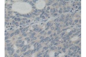 Immunohistochemistry (IHC) image for anti-ATP-Binding Cassette, Sub-Family B (MDR/TAP), Member 5 (ABCB5) (AA 570-808) antibody (ABIN7442258)