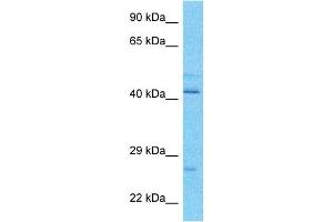 Western Blotting (WB) image for anti-ATPase, H+ Transporting, Lysosomal 31kDa, V1 Subunit E1 (ATP6V1E1) (N-Term) antibody (ABIN5514460)