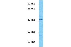Host:  Rabbit  Target Name:  VATE1  Sample Type:  OVCAR-3 Whole Cell lysates  Antibody Dilution:  1. (ATP6V1E1 抗体  (N-Term))