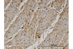 Immunoperoxidase of monoclonal antibody to PANK4 on formalin-fixed paraffin-embedded human heart. (PANK4 抗体  (AA 673-773))