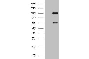 Western Blotting (WB) image for anti-ADAM Metallopeptidase with Thrombospondin Type 1 Motif, 4 (ADAMTS4) (AA 296-577) antibody (ABIN2715720) (ADAMTS4 抗体  (AA 296-577))